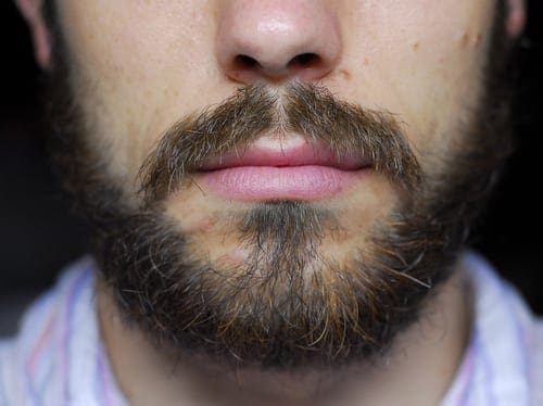 Facial Hair Eeew...