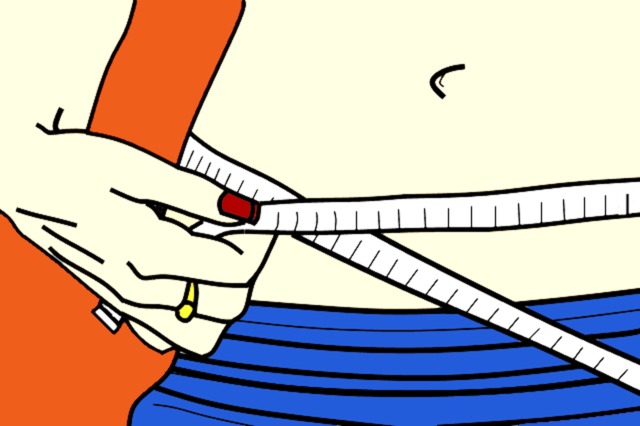 obesity surgery