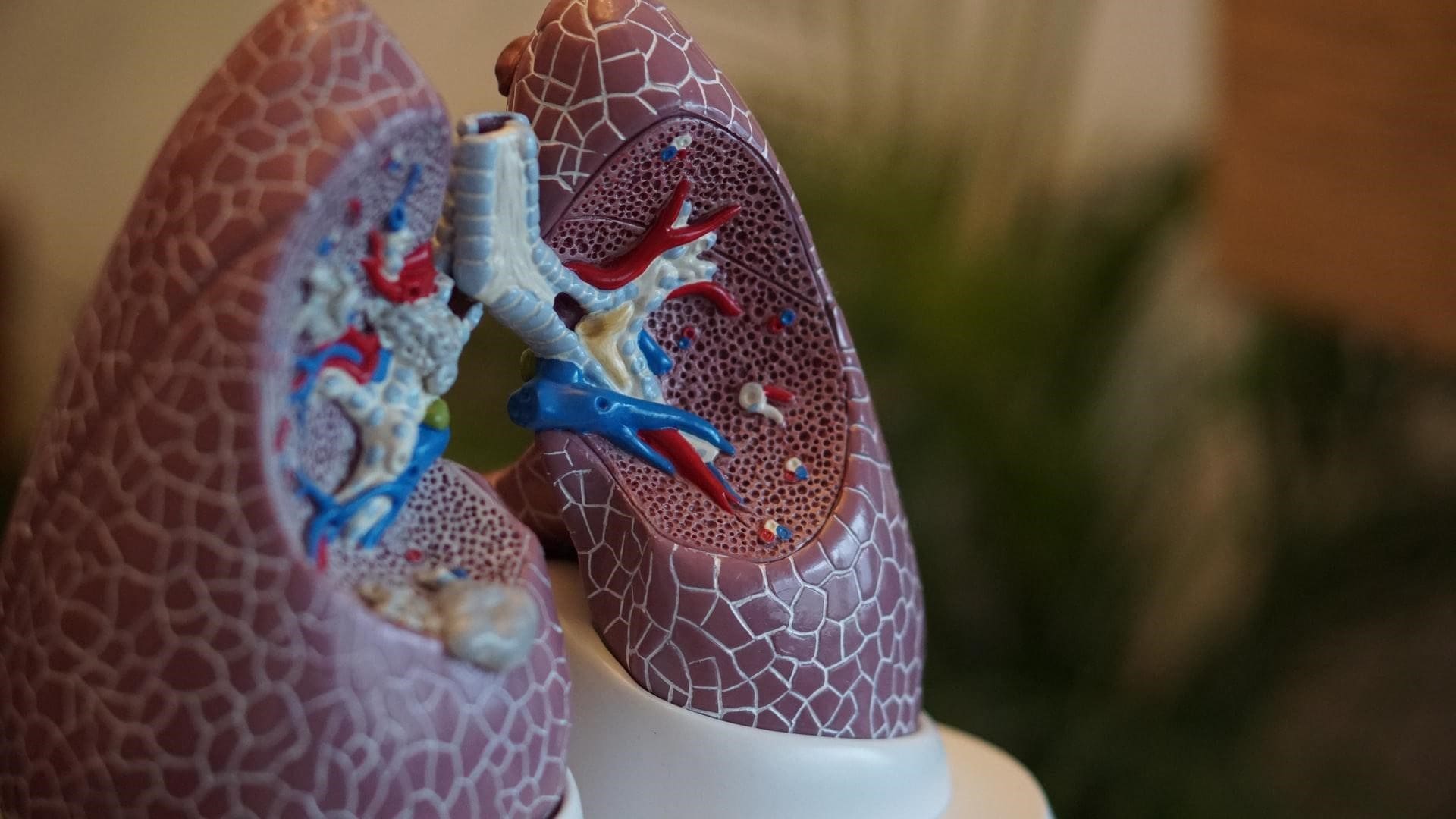 lung model pulmonary embolism