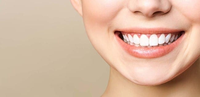 Teeth Whitening Perfect Smile