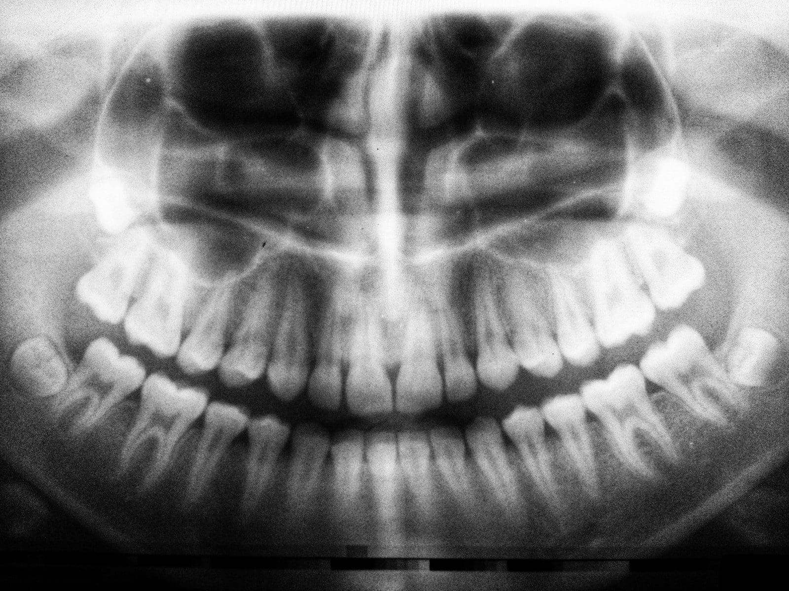 teeth X-ray artificial intelligence
