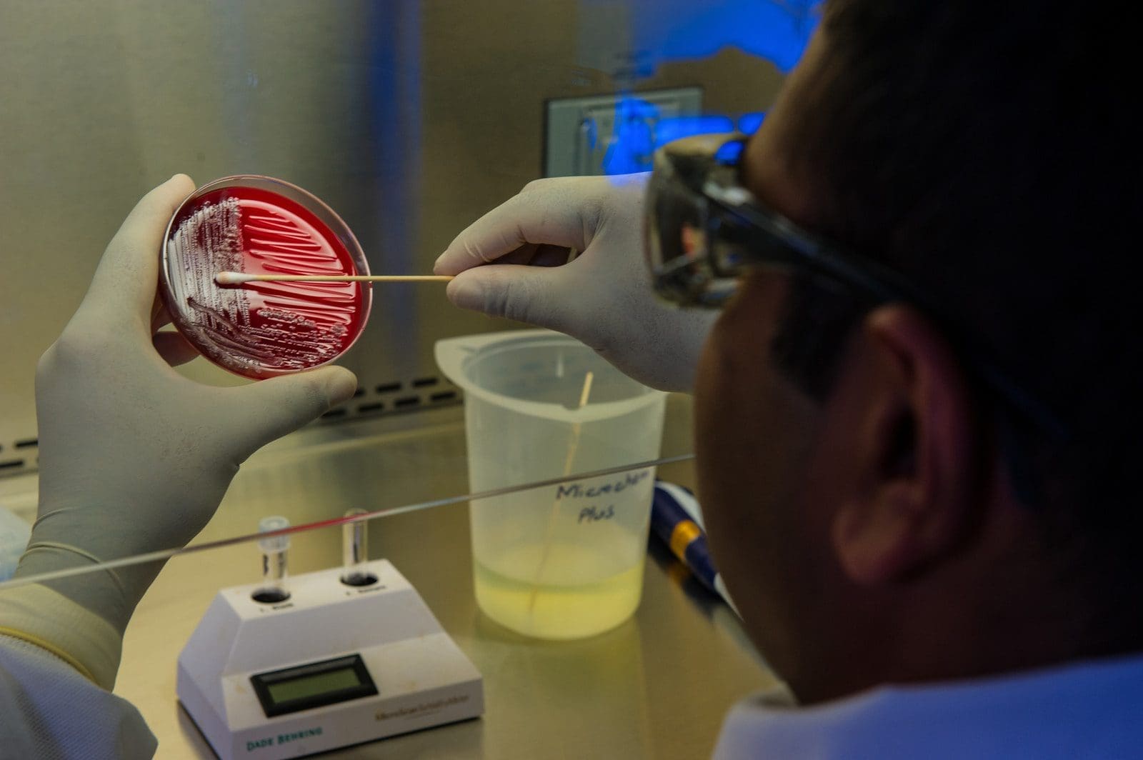 microbiology person holding black framed eyeglasses