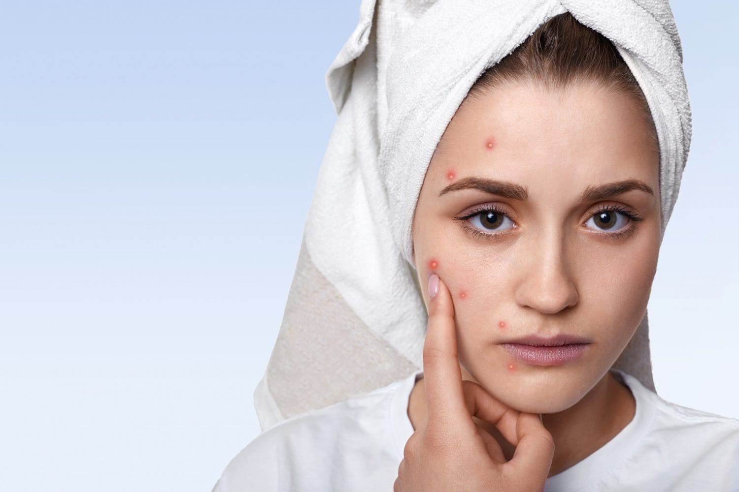 Are Cosmetic Companies Fooling You? Here’s How You’re Getting Scammed! 1 cosmetic companies acne