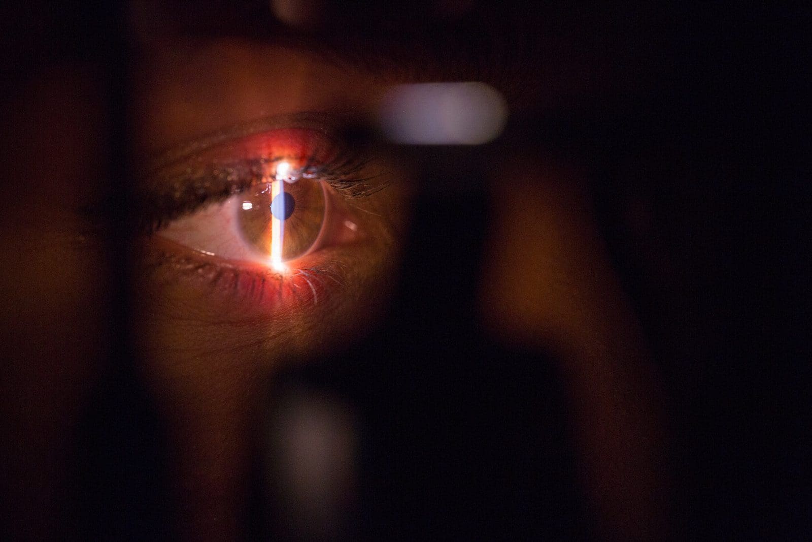 Photo by Brands&People eye surgery