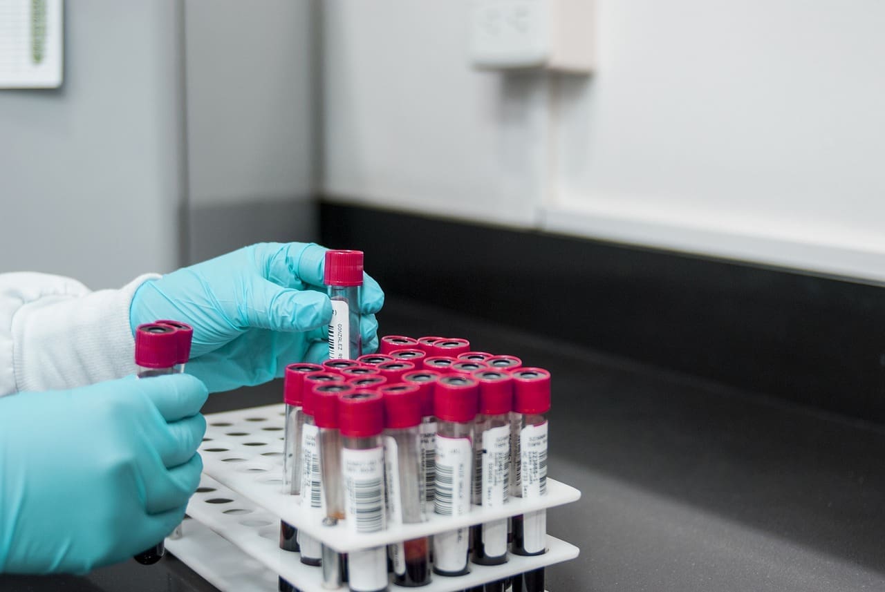 Identifying Genital Herpes Incognito And Herpes Testing 2 lab, experiment, test
