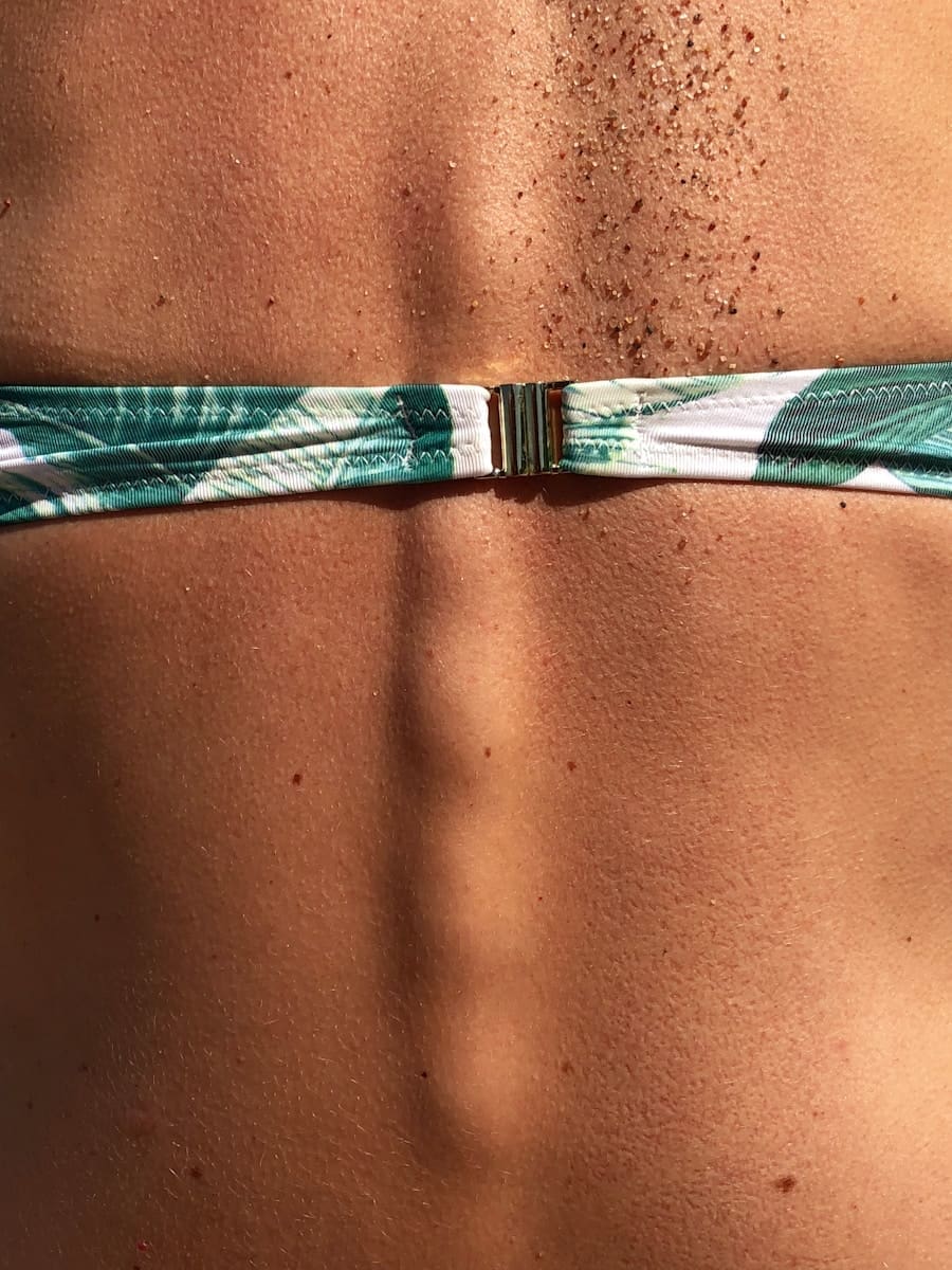 green and white bikini top skin cancer