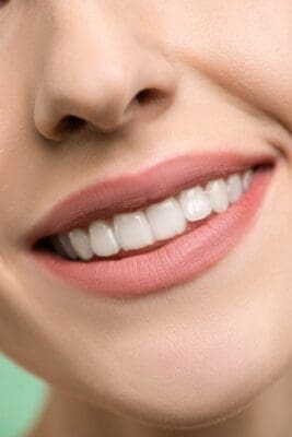A close-up image focusing on a woman's smiling mouth, showing white teeth and pink lips. Cosmetic Dentistry