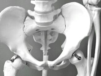 The Most Common Causes of Pelvic Floor Muscle Weakness in Women and Men